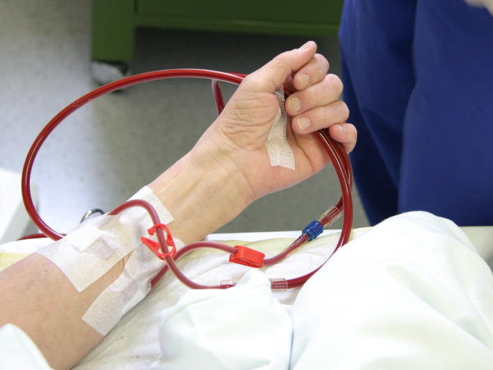Dialyse Arm von Patientin mit Blut gefüllten Schläuchen