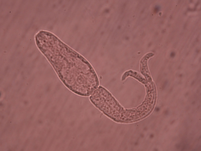 Schistosoma mansoni zelle